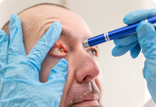 Dilation and probing of lacrimal canaliculi