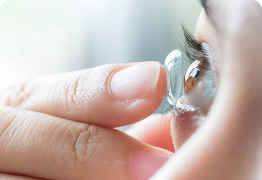 Fitting of contact lenses